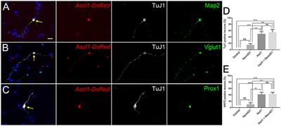 Direct Reprogramming of Spiral Ganglion Non-neuronal Cells into Neurons: Toward Ameliorating Sensorineural Hearing Loss by Gene Therapy